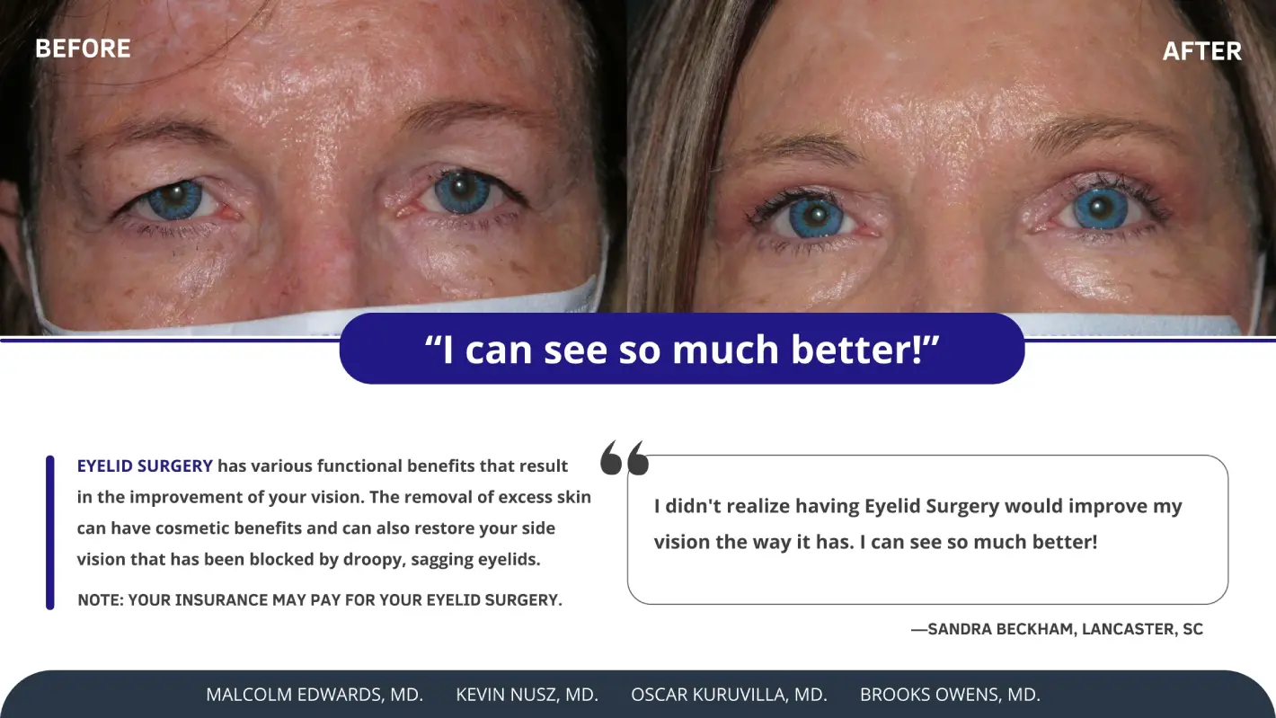 2-Sandra-Beckham-Eyelid-Surgery-Testimonial-2.jpg